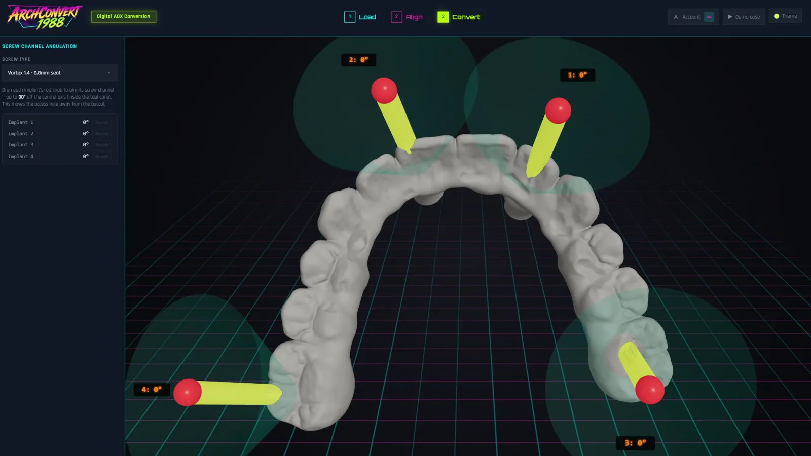 Screw channel angulation: per-implant cone showing the allowed tilt range with a draggable handle aiming the channel