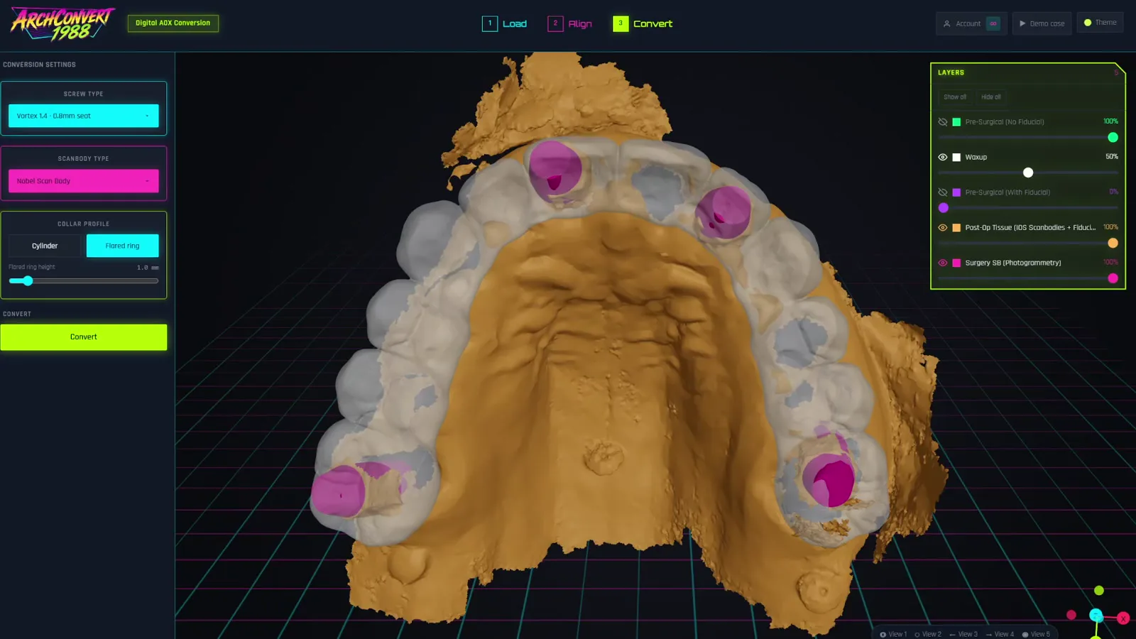 Convert step: detected scan bodies, collars and screw channel indicators on the wax-up