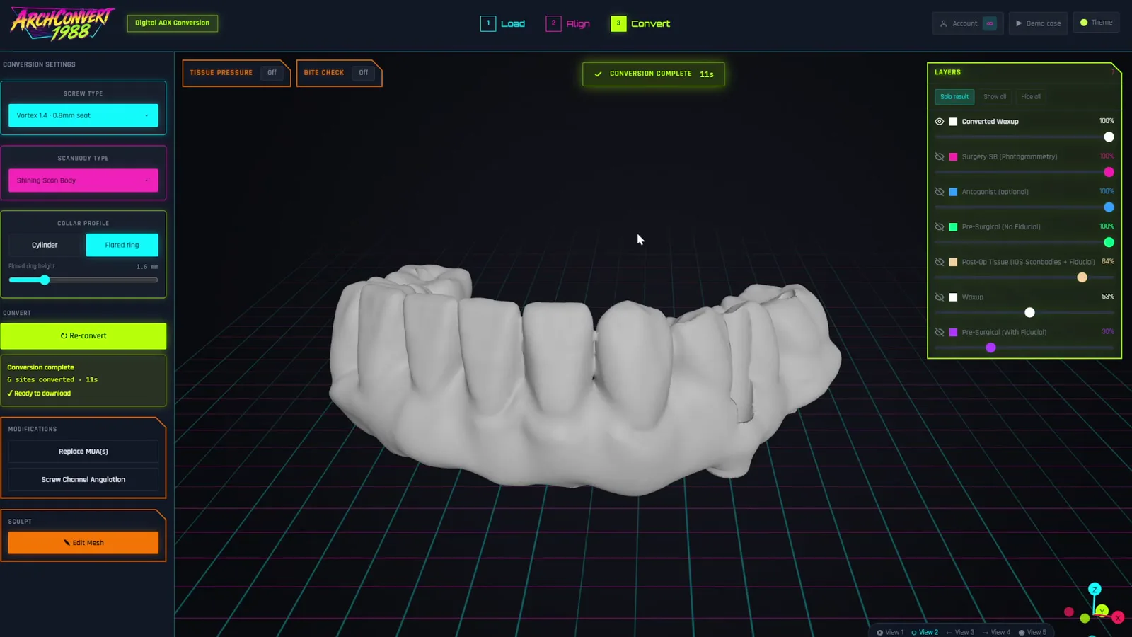 ArchConvert Convert step: aligned scans with detected implants and screw-channel preview